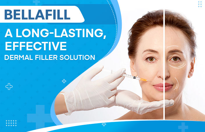 Bellafill A Long Lasting Effective Dermal Filler Solution