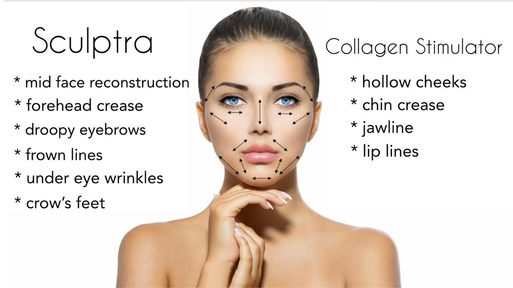 skin restructuring with sculptra injectable treatment 1